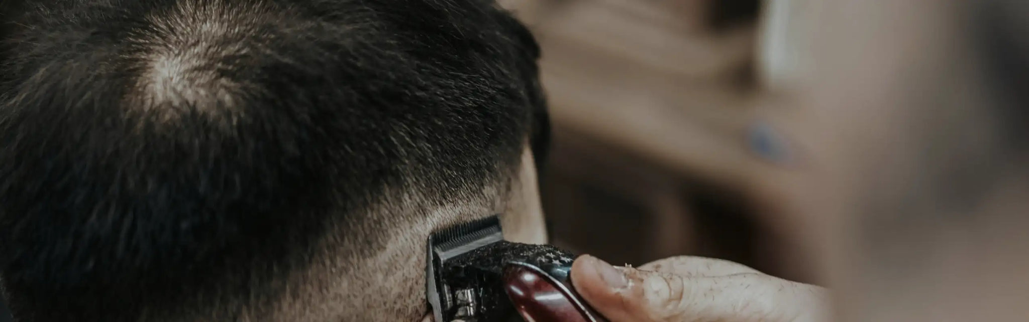 Haarausfall bei Männern – Ursachen und Behandlung